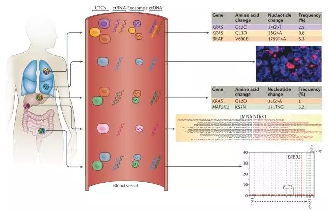 Nature Reviews：整合的液體活檢方案用于管理癌癥&mdash;&mdash;ctDNA、CTCs和exosomes