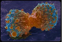 我國細胞免疫治療腫瘤或將進入快車道